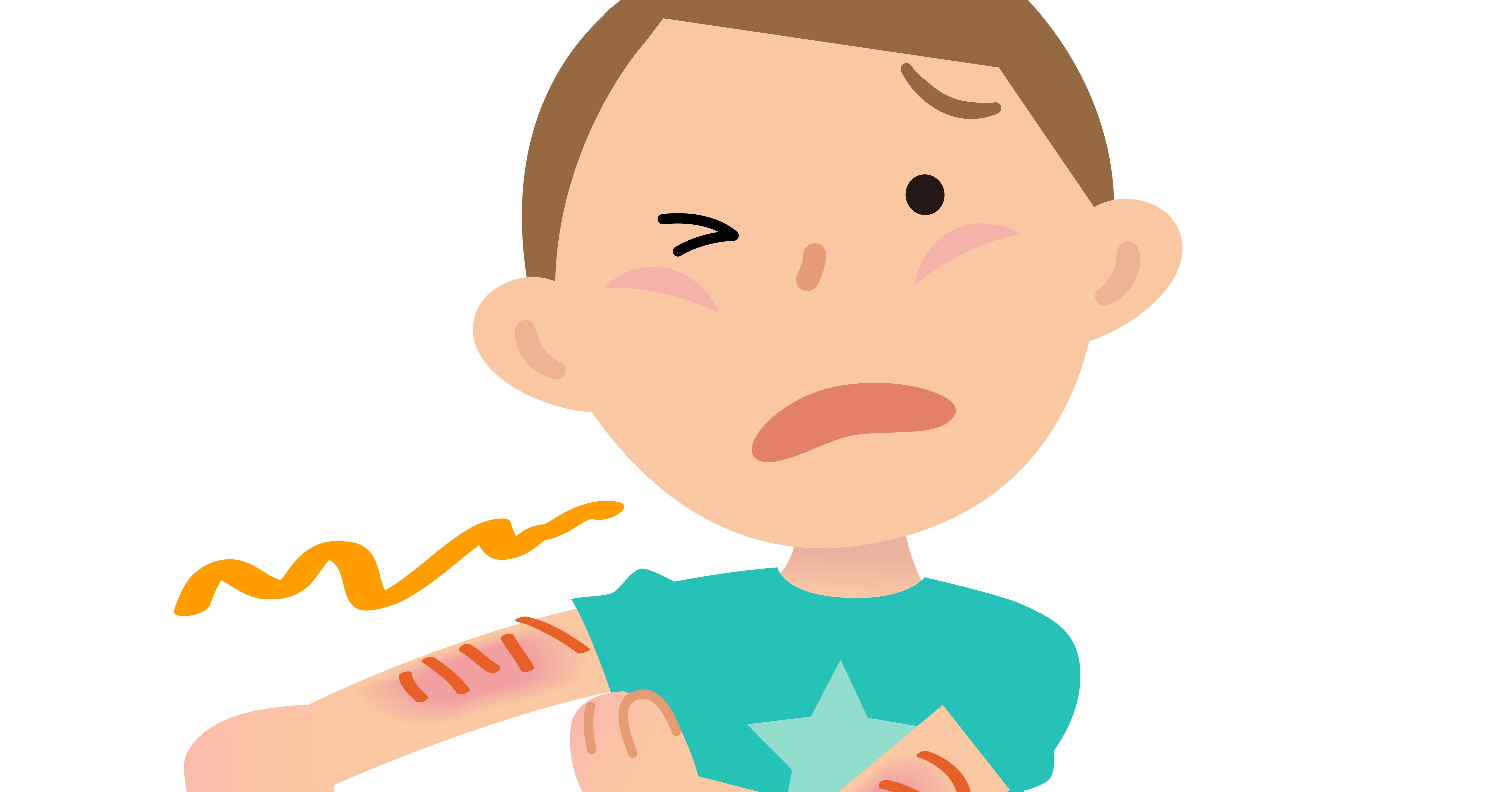 アトピー性皮膚炎で悩んでいる人へ 30年の長きにわたる僕のアトピー対策とは すがの暮らし Sugalife Note アトピー性皮膚炎で悩んでいる人へ 30年の長きにわたる僕のアトピー対策とは すがの暮らし Sugalife Note