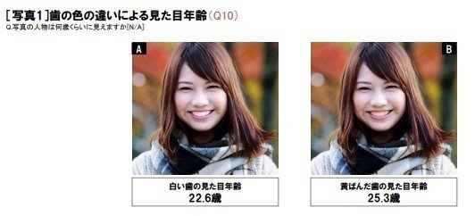 歯の黄ばみ の新着タグ記事一覧 Note つくる つながる とどける