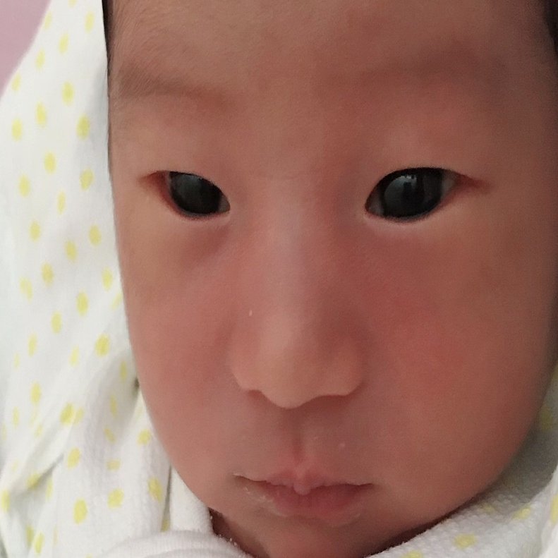 生後10ヶ月 赤ちゃんの頃一重でもその後二重になるのか 経過観察 写真あり 知育オタク Note