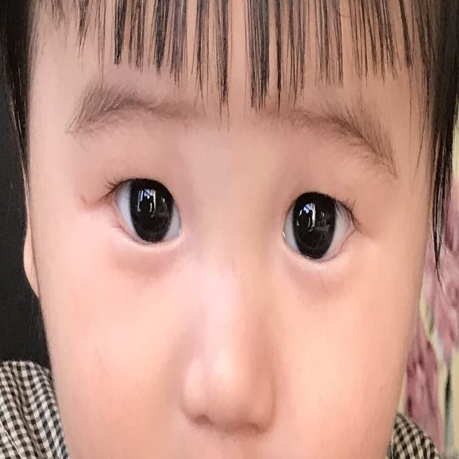 生後10ヶ月 赤ちゃんの頃一重でもその後二重になるのか 経過観察 写真あり 育児マニア Note