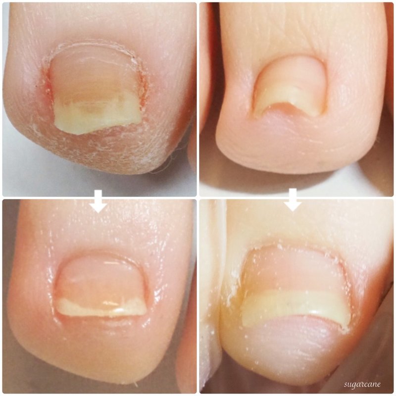 小さい爪 Nailsalon Sugarcane Note