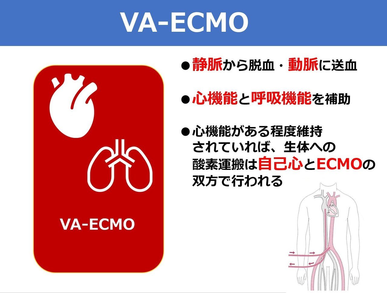 疑問】ECMOとは？ウイルス性肺炎の治療に使われるECMOについて解説