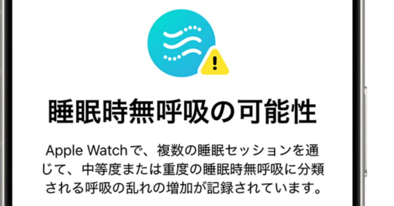 Apple Watchのアラートをするするするー｜ウラナイ8号室