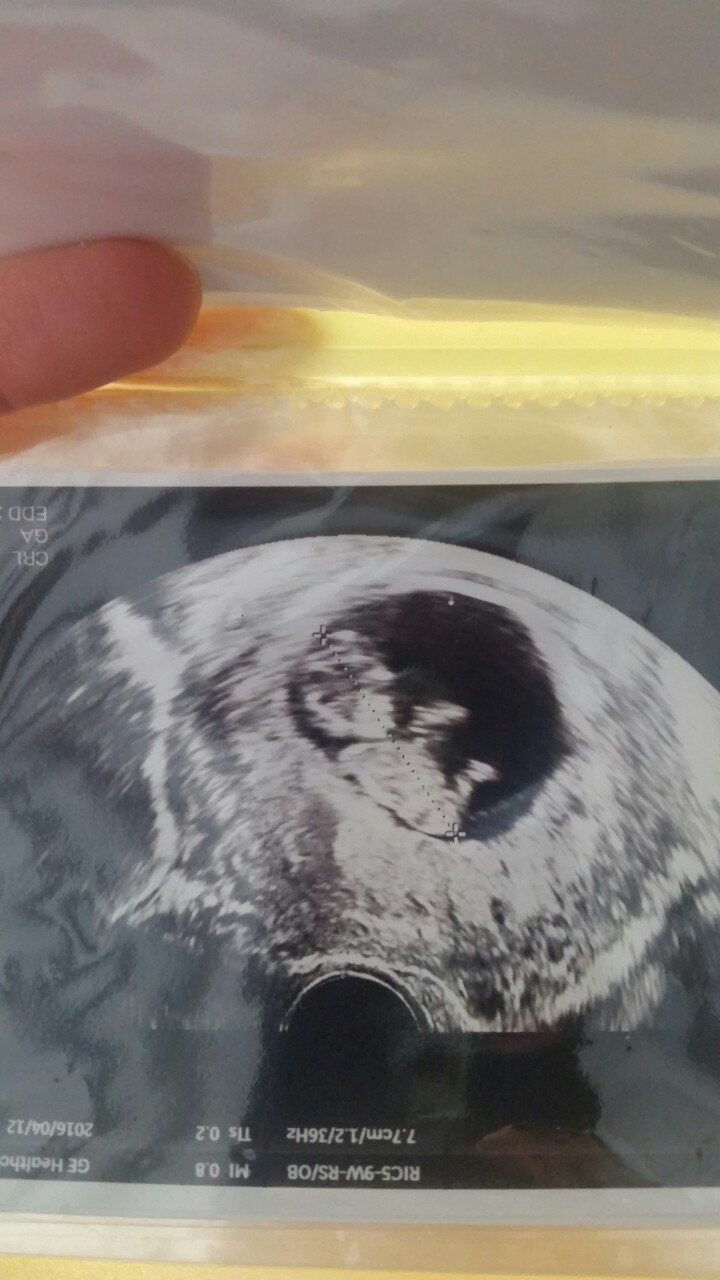 11w1d すごいねーー神秘 Myu Note