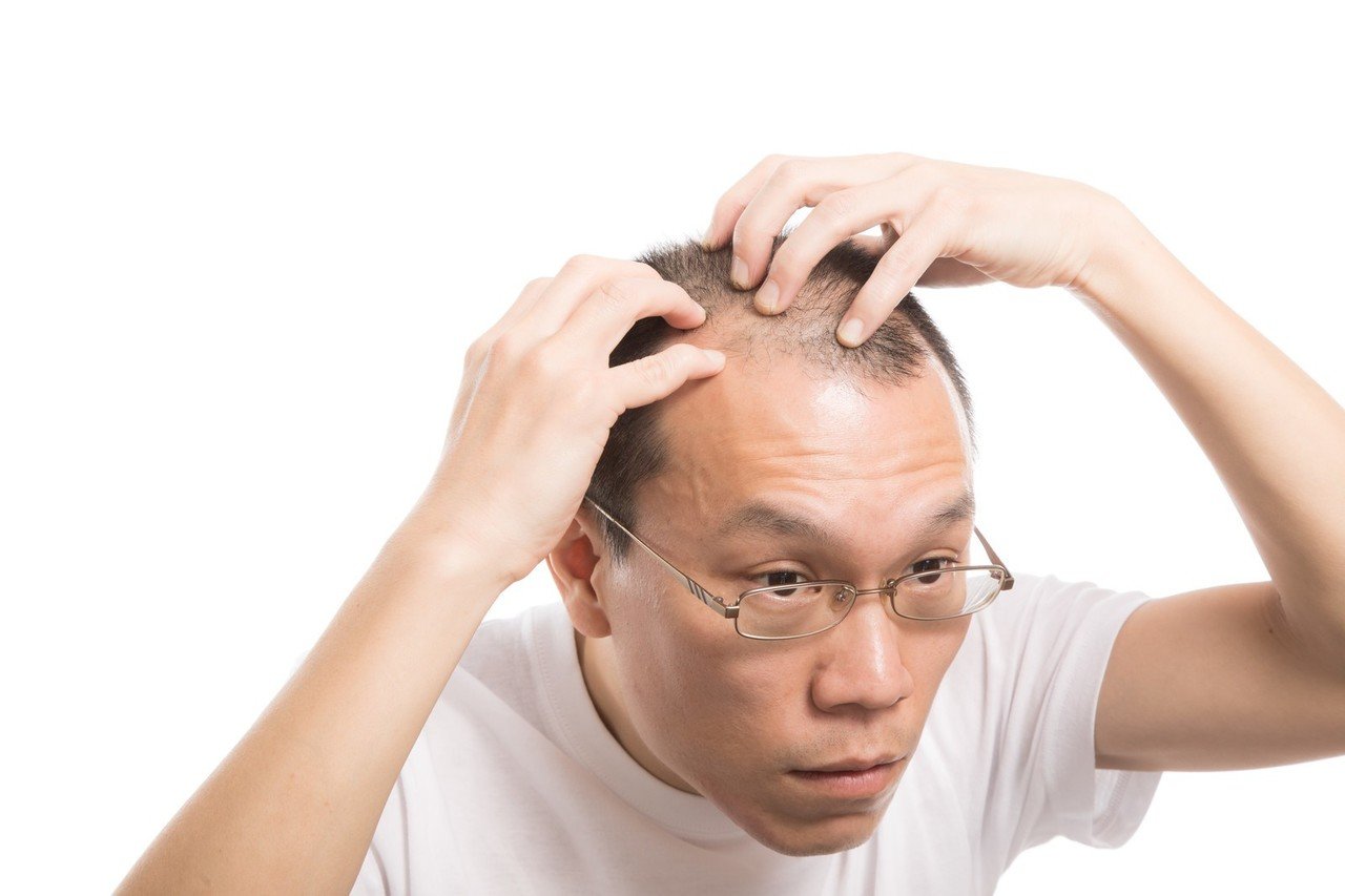 ハゲ杯 一日当たり100本の髪の毛が抜けるのが普通 阿部優樹 あべゆう プロカメラマンを目指す高専生 Note ハゲ杯 一日当たり100本の髪の毛が抜けるのが普通 阿部優樹 あべゆう プロカメラマンを目指す高専生 Note