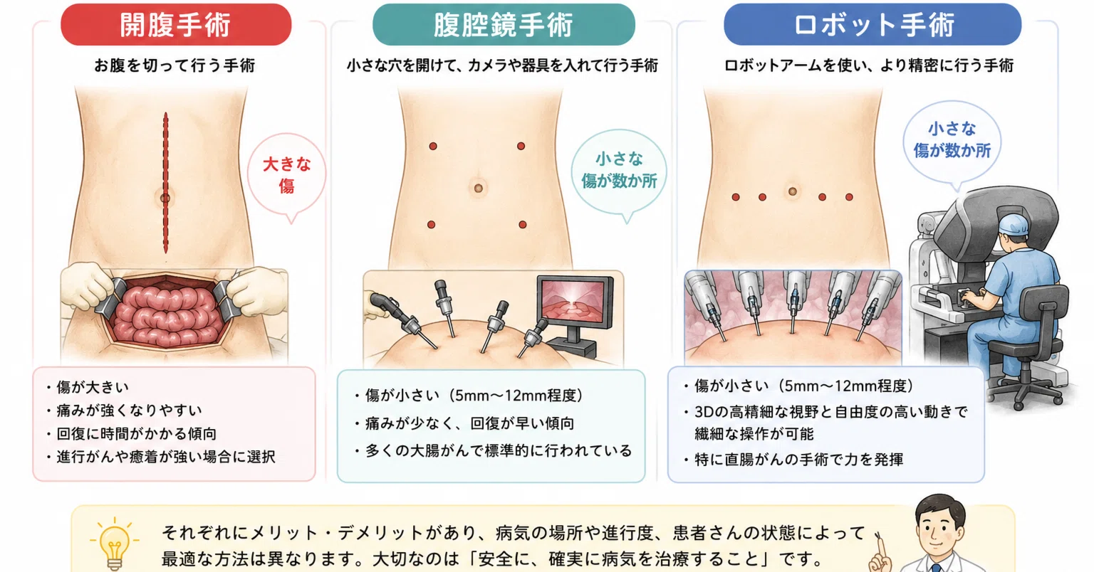 大腸癌手術」の人気タグ記事一覧｜note ――つくる、つながる、とどける。