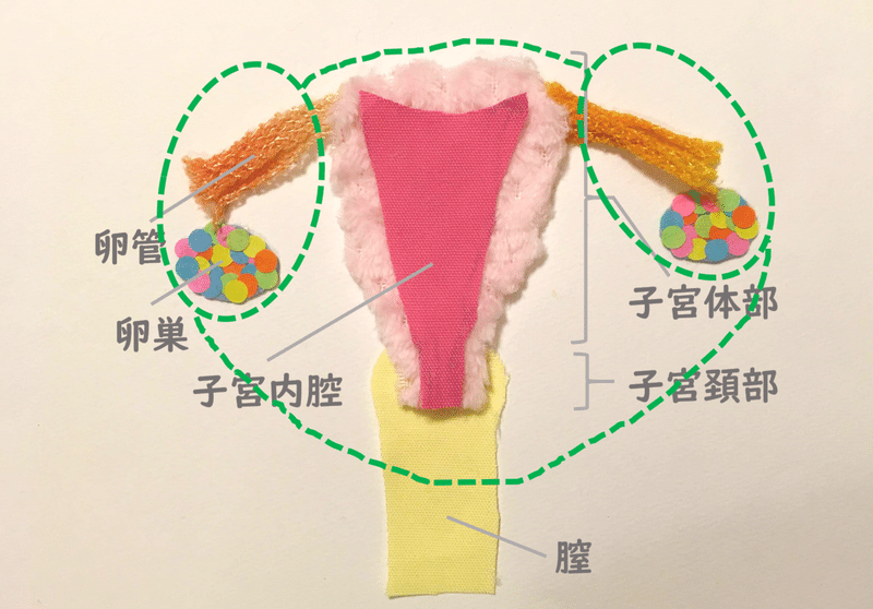 広汎子宮全摘術