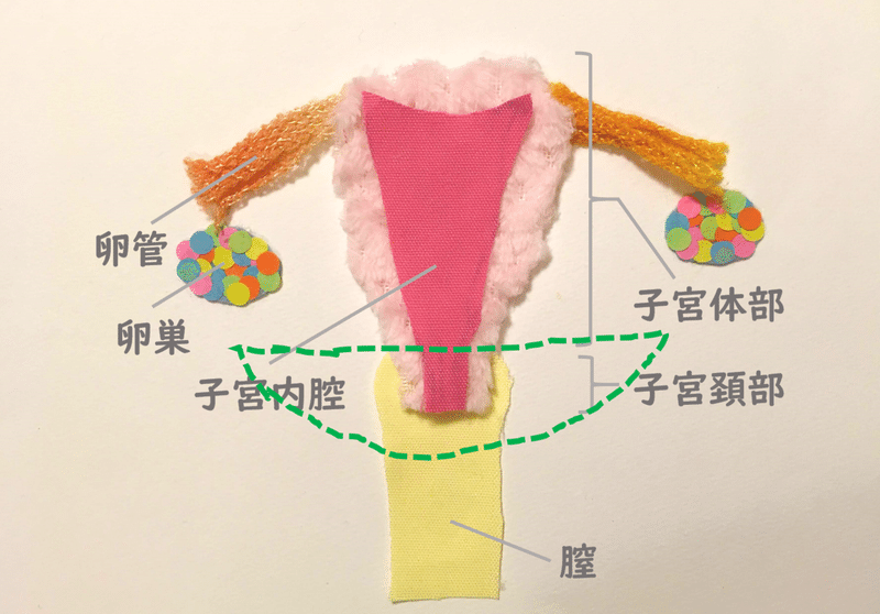 広汎頚部摘出術