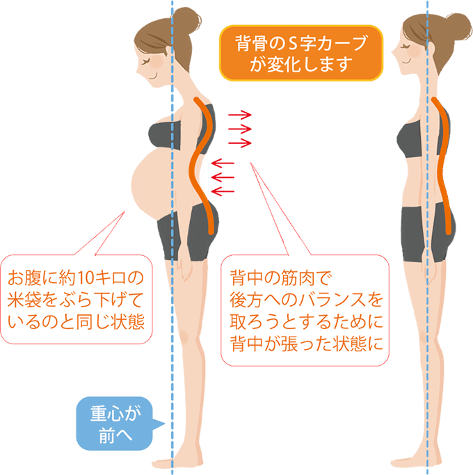 妊婦さん必見 腰痛の原因と予防法 男性不妊症へのへのでっぱの育児日記 Note 妊婦さん必見 腰痛の原因と予防法 男性不妊症へのへのでっぱの育児日記 Note
