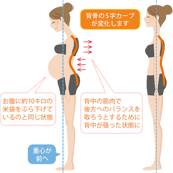 妊婦 歩く と 腰痛