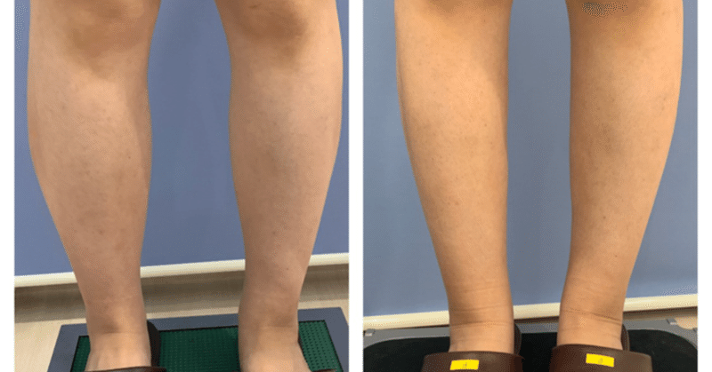 ベイザー の新着タグ記事一覧 Note つくる つながる とどける