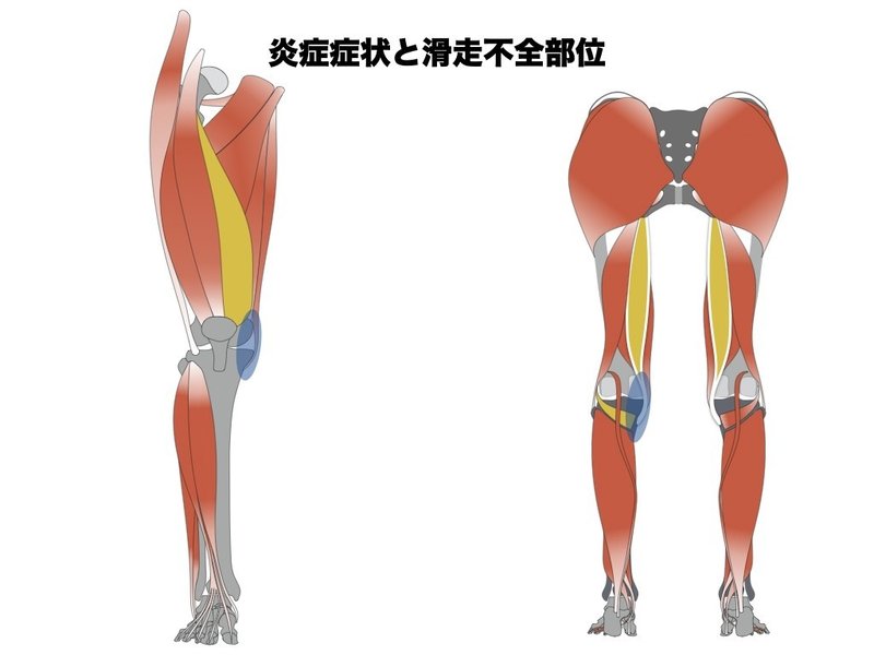 膝内側側副靭帯損傷の理学療法 アスレティックリハビリテーション 平 純一朗 Pt Jspo At Note