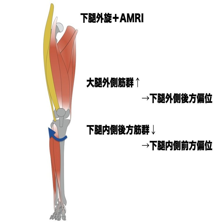 膝内側側副靭帯損傷の理学療法 アスレティックリハビリテーション 平 純一朗 理学療法士 アスレティックトレーナーnote Note