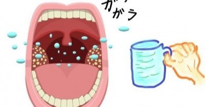 臭い玉 膿栓 をうがいで取るには ちょっとしたコツがいります Uebayashi Note