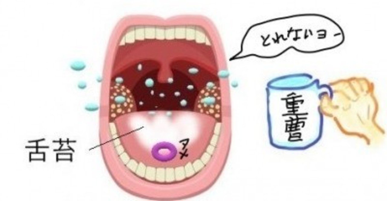 重曹うがいは虫歯予防に効果があると思いますか Uebayashi Note
