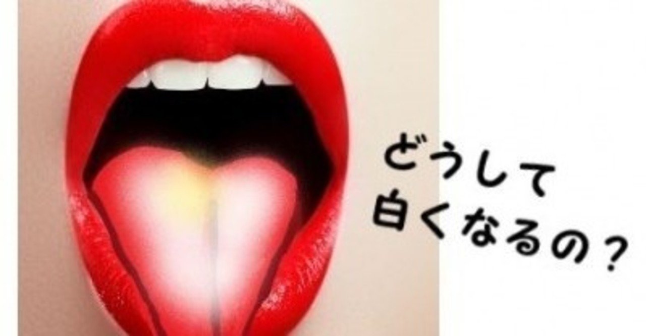舌が白いのは病気なの 舌で健康チェックする時のポイント Uebayashi Note