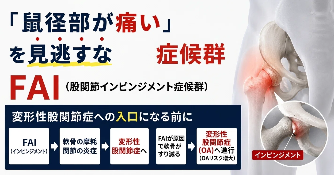 鼠径部が痛い」を見逃すなーFAI（股関節インピンジメント症候群）が