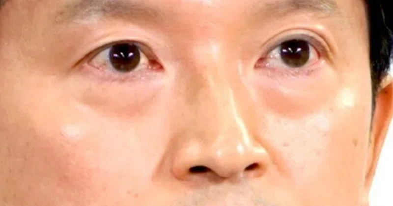 【選挙ウォッチャー】 週刊元彦問題（＃３０）。