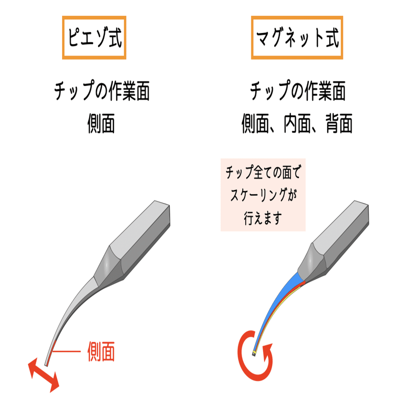 超音波スケーラーの種類｜歯科衛生士EMIKA
