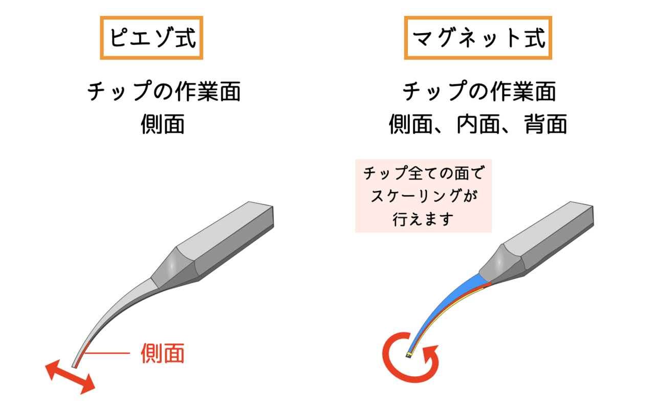 超音波スケーラーの種類|歯科衛生士EMIKA