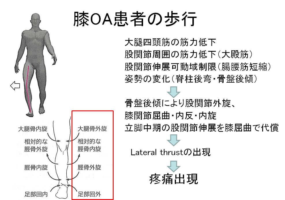 変形性膝関節症について（評価編）｜タカボーラボ