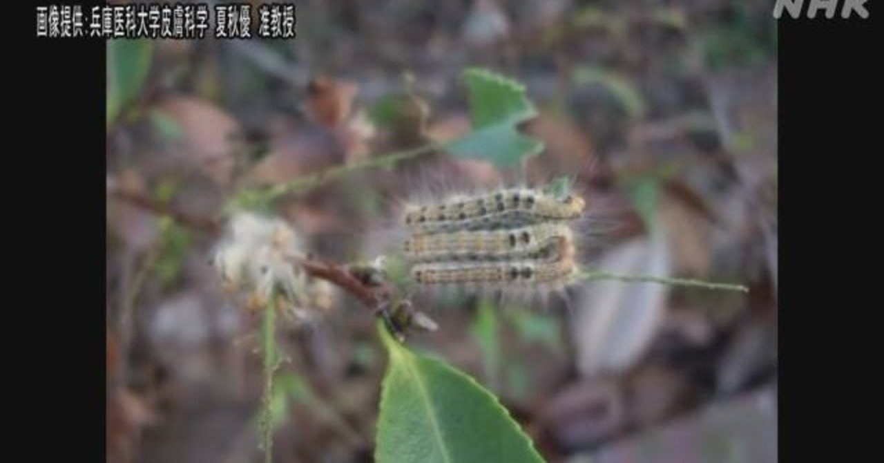 毒持つ毛虫 チャドクガ 大量発生 皮膚炎の患者相次ぐ 千葉 年6月25日 11時58分 外出する機会が増える中 千葉県などでは チャドクガ というガの 毒を持つガの毛虫が大量に発生し 風で飛び 風見鶏 Note 毒持つ毛虫 チャドクガ 大量発生 皮膚炎の患者相次ぐ 千葉 年6月25日 11時58分 外出する機会が増える中 千葉県などでは チャドクガ というガの 毒を持つガの毛虫が大量に発生し 風で飛び 風見鶏 Note