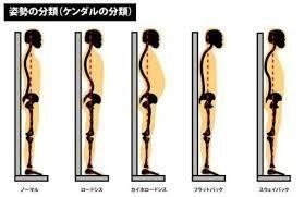 正しい姿勢と不良姿勢｜スポーツ総合治療院ACT