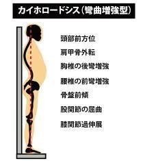 正しい姿勢と不良姿勢｜スポーツ総合治療院ACT