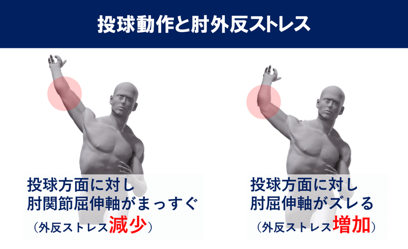 投球動作と肘外反ストレス