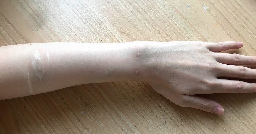 どうしてリスカをしてはいけないの 自傷行為を続けるリスク やめさせる方法も 工藤美寿樹 Note どうしてリスカをしてはいけないの 自傷行為を続けるリスク やめさせる方法も 工藤美寿樹 Note