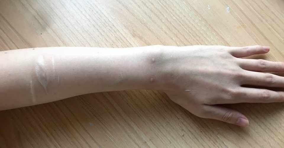 どうしてリスカをしてはいけないの 自傷行為を続けるリスク やめさせる方法も 工藤美寿樹 Note