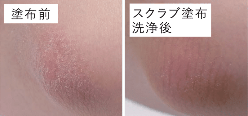 夏ゴワ肌も ツルスベ に 熱烈オファーで復活した新商品とは こよりつづり Coyori Note 夏ゴワ肌も ツルスベ に 熱烈オファーで復活した新商品とは こよりつづり Coyori Note