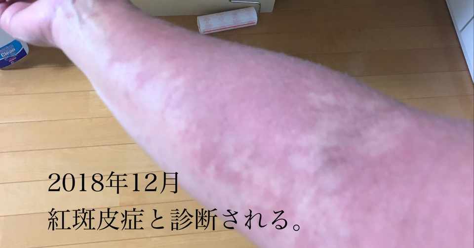 写真で振り返るアトピーのような症状と闘った1年間 脱ステロイド 脱保湿 色々試したけれど 大切なのはたった一つ 自分で決めることだった 長尾 瞳 Note