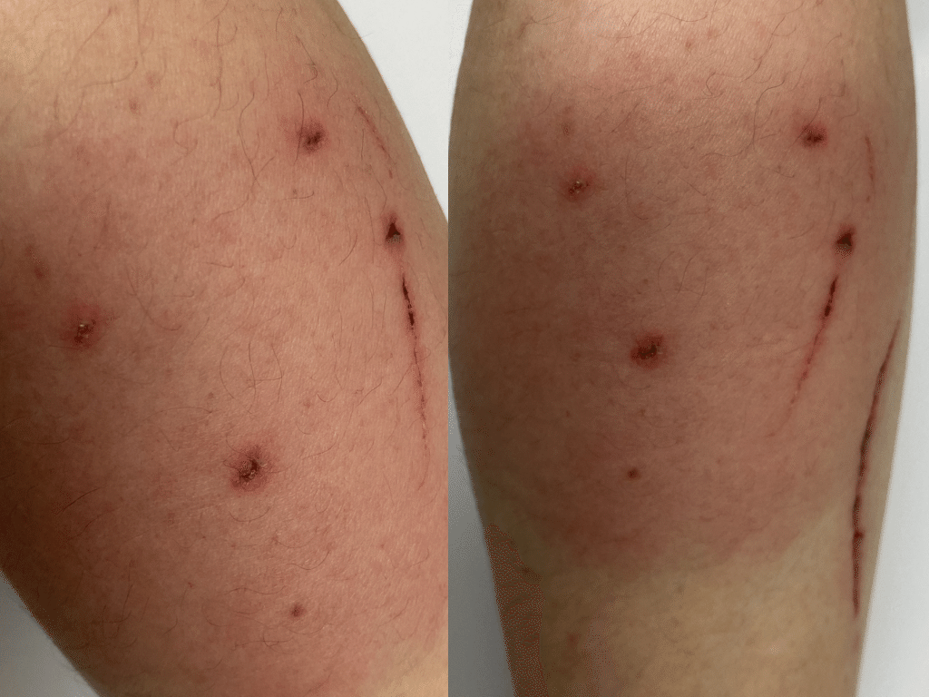 53 猫に噛まれた どうする Sounet Note 53 猫に噛まれた どうする Sounet Note