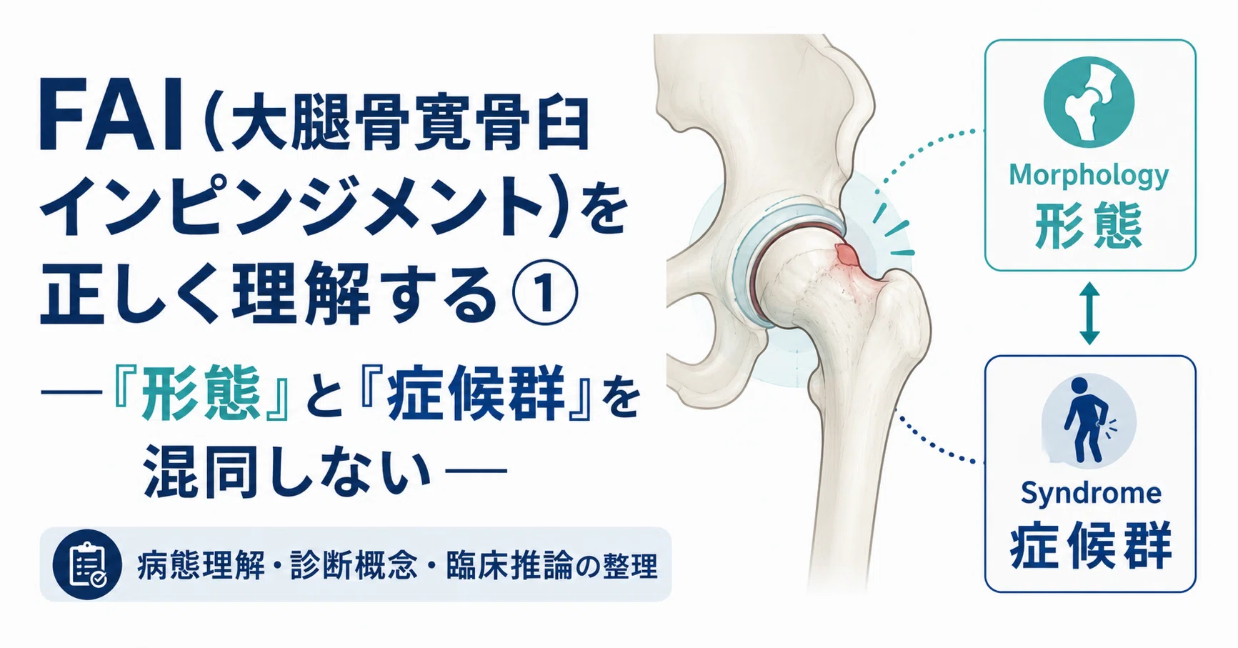 FAI(大腿骨寛骨臼インピンジメント)を正しく理解する① ―「形態」と