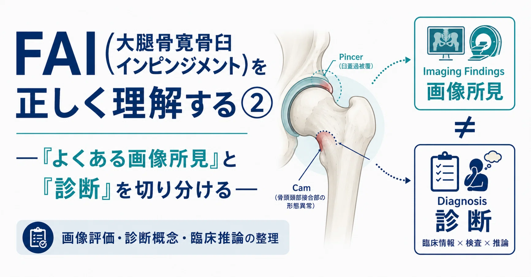 FAI(大腿骨寛骨臼インピンジメント)を正しく理解する② ―「よくある
