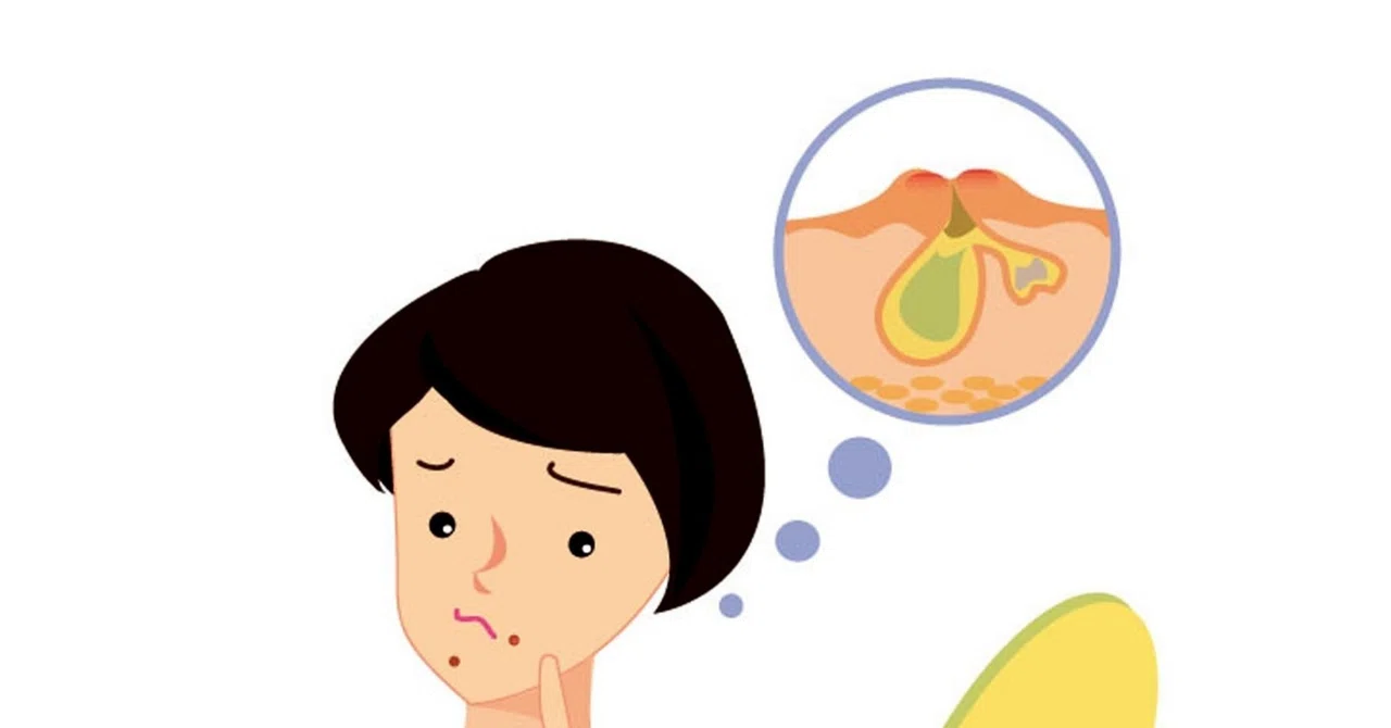 【新人医療事務員向け】DPC暗号解読ガイド:080010 湿疹、皮膚炎群|Theme Japan