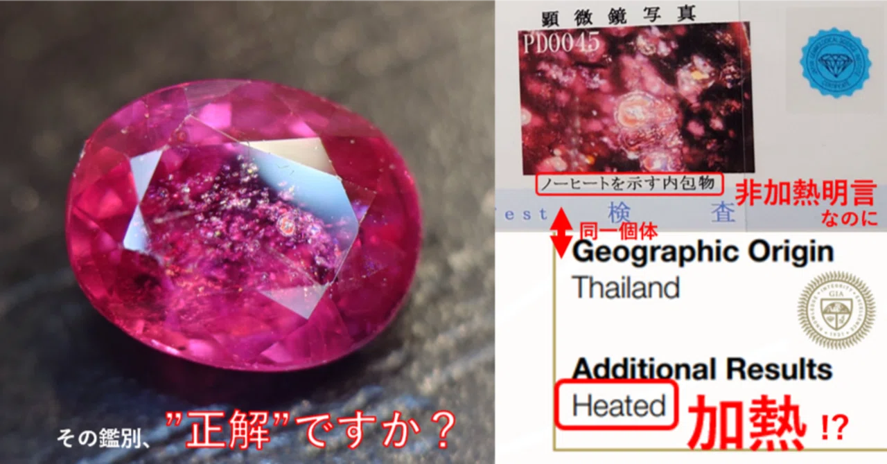その鑑別、