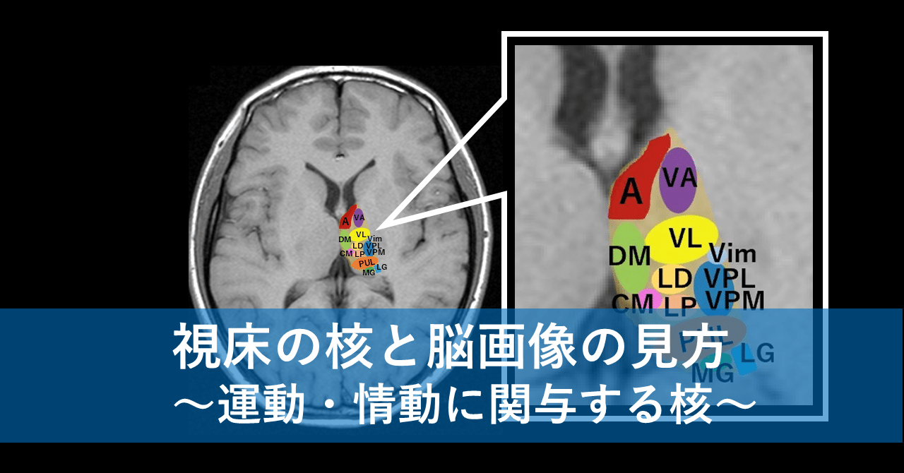 視床の核と脳画像の見方 運動 情動に関与する核 脳卒中に関する知識整理note Note