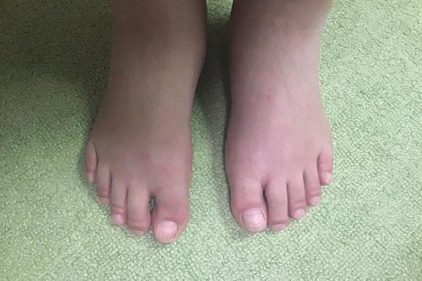 足の甲の浮腫み の新着タグ記事一覧 Note つくる つながる とどける 足の甲の浮腫み の新着タグ記事一覧 Note つくる つながる とどける