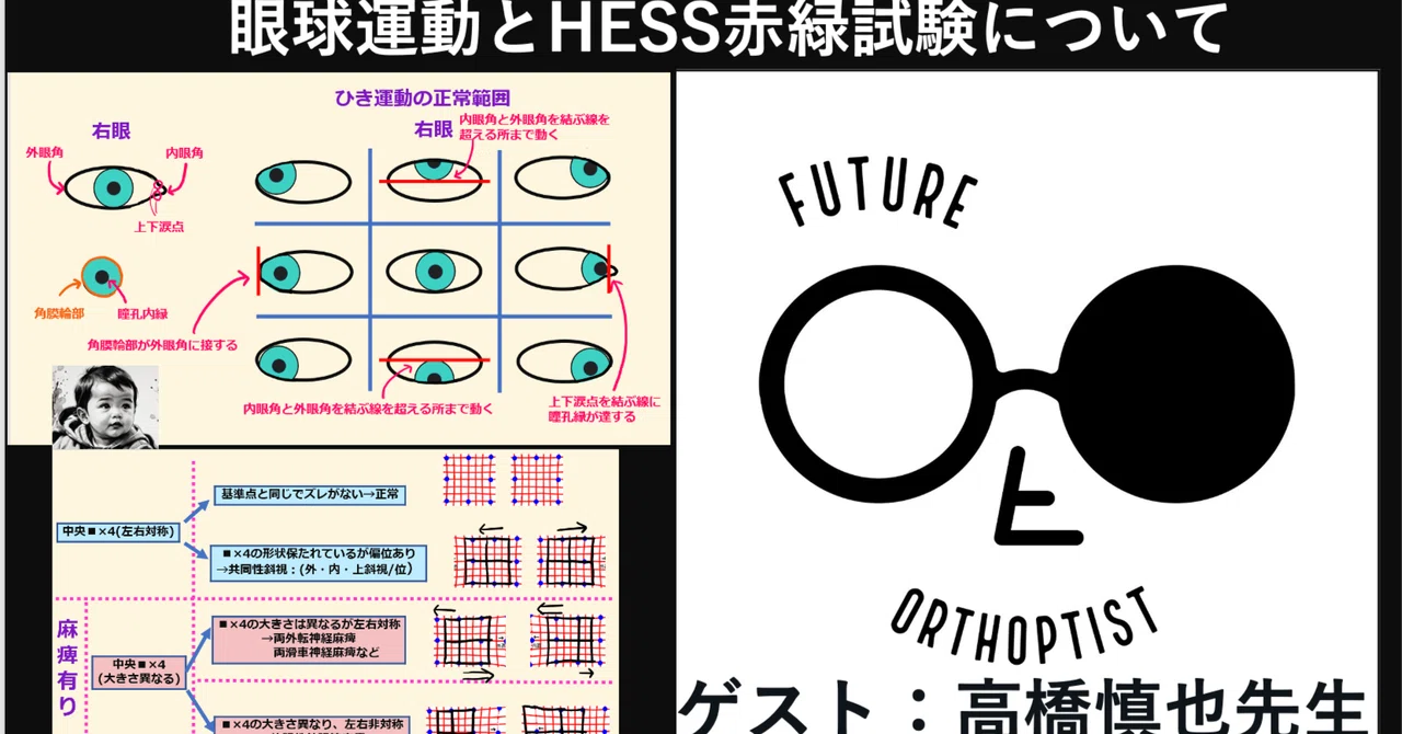 眼球運動とHESS赤緑試験など （ひき、むき運動、Heringの法則など