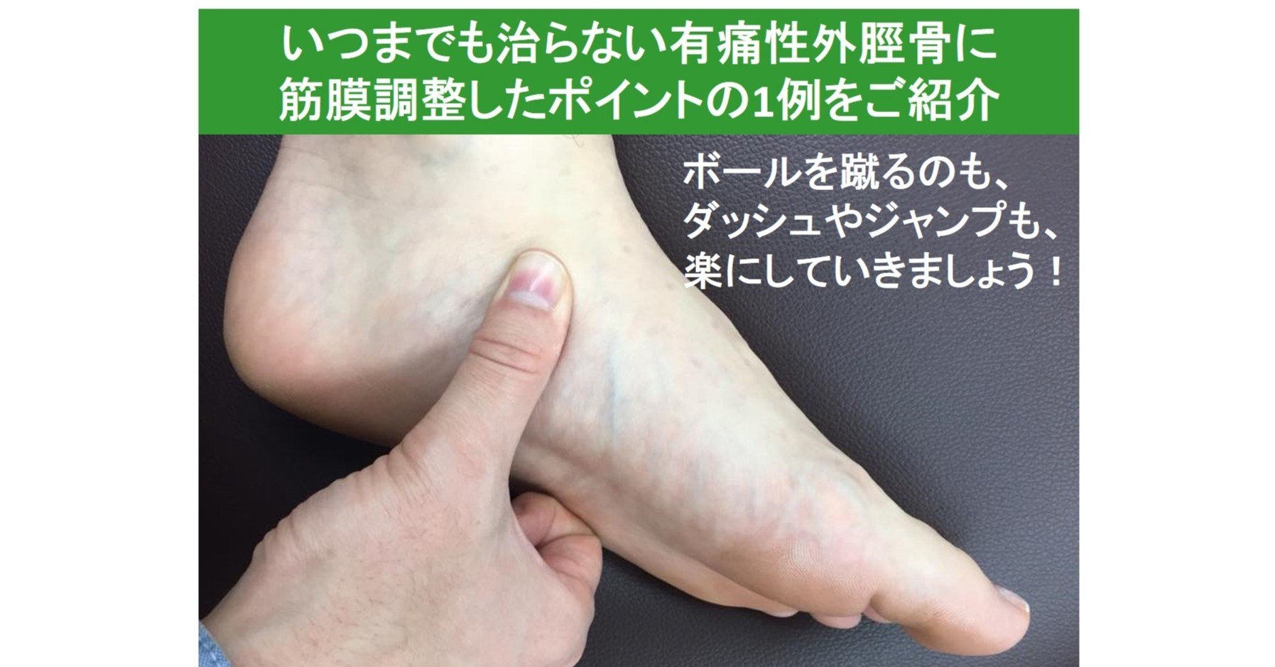 外 性 有 ストレッチ 痛 脛骨