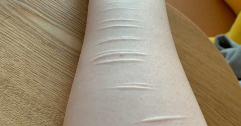 リスカ痕 メルちゃん Note