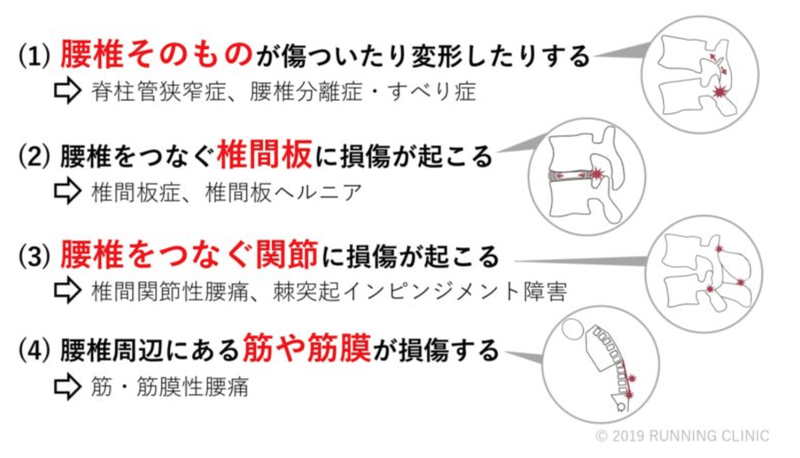 3ヶ月で腰痛を根本から改善させます Back Aging 腰痛 肩こり専門治療院 Back Aging 広報日記 Note 3ヶ月で腰痛を根本から改善させます Back Aging 腰痛 肩こり専門治療院 Back Aging 広報日記 Note