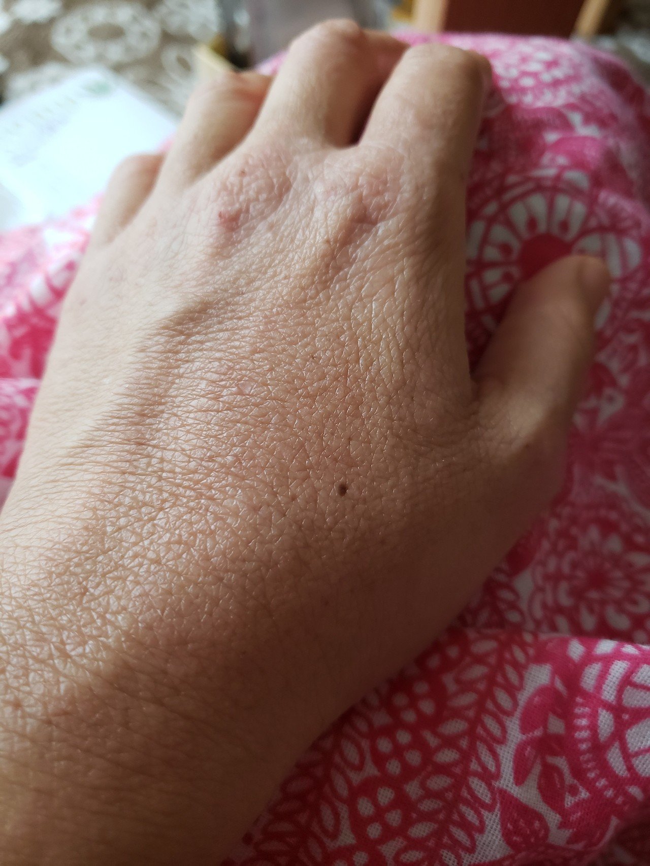 かなりキメが荒いけど だいぶ綺麗になりました 満天優 Note