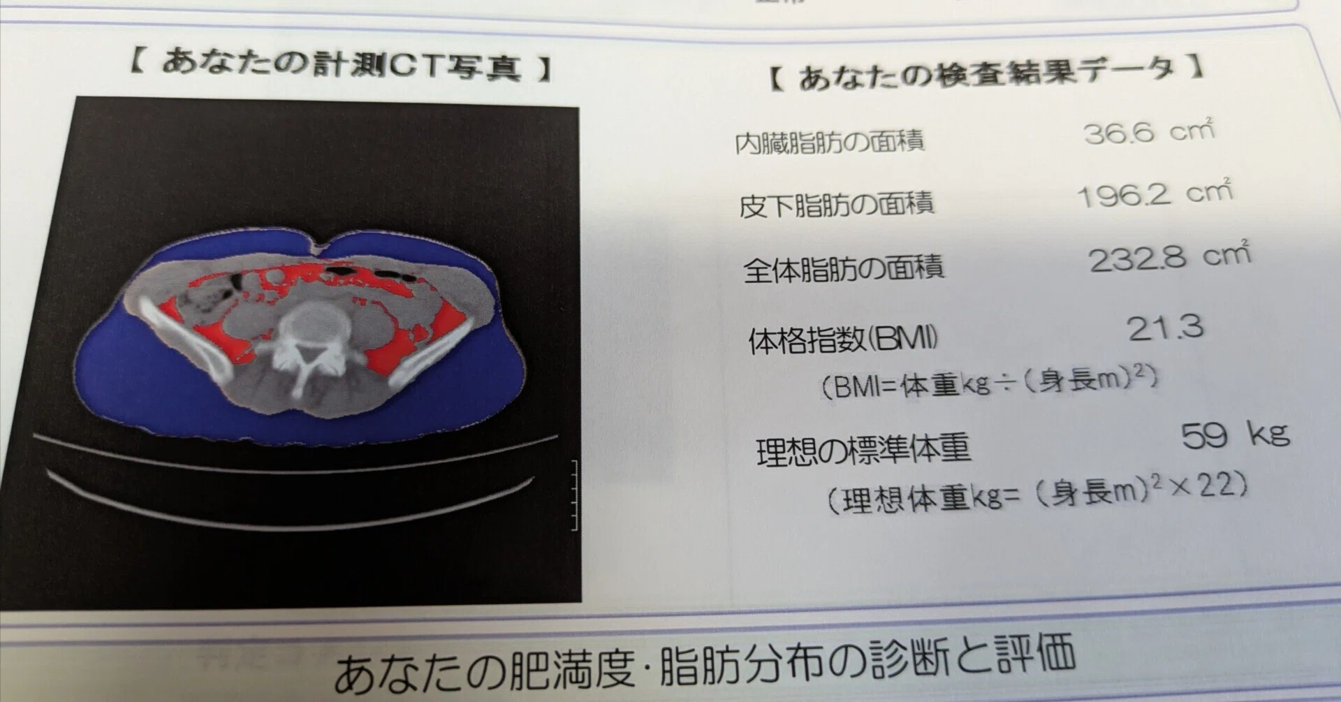 毎年恒例！！ 結果発表2026年 ～ 人間ドック ～｜TSN