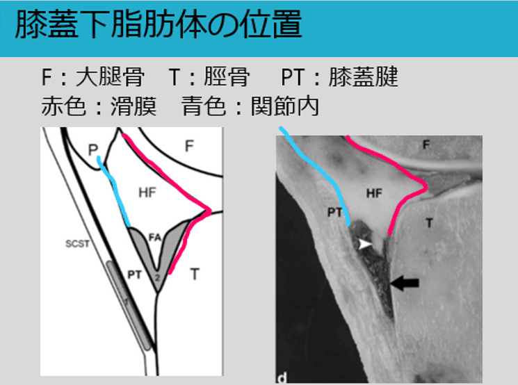 膝蓋下脂肪体の基本を知る Y K Note 膝蓋下脂肪体の基本を知る Y K Note