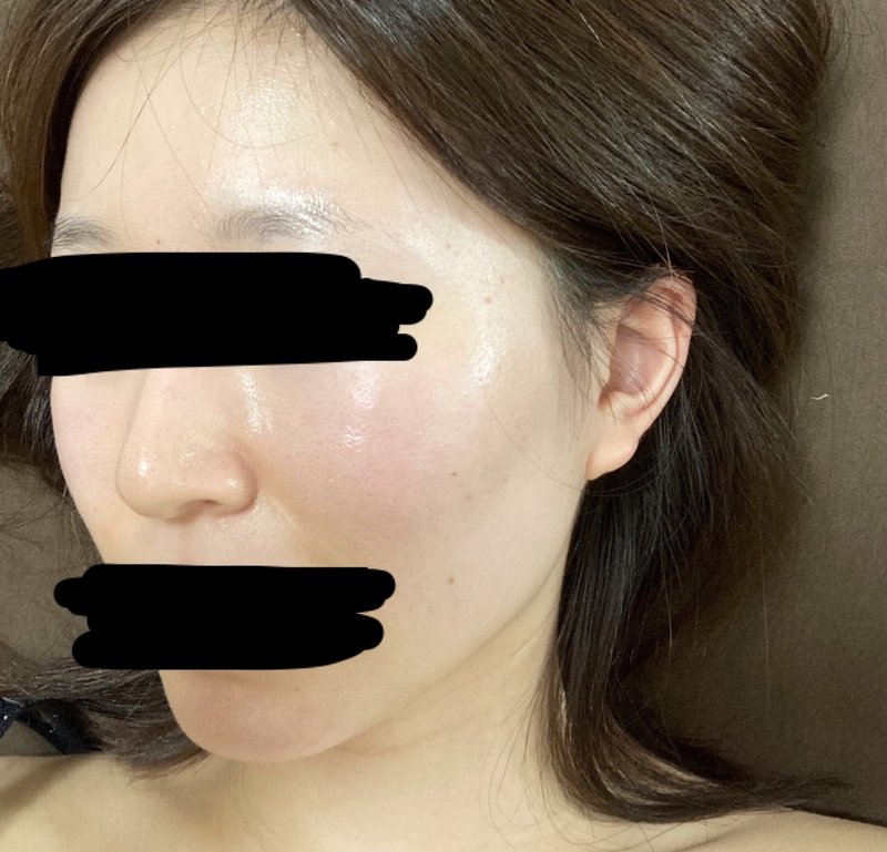 汚肌から美肌への道 おはだこ Note