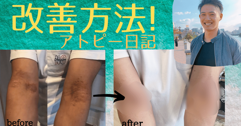 アトピーが改善する食べ物 算数オンライン家庭教師 倉永 将太朗 Note アトピーが改善する食べ物 算数オンライン家庭教師 倉永 将太朗 Note