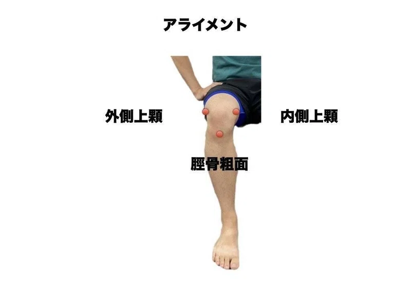 膝関節のアライメント キネマティクス評価 平 純一朗 Pt Jspo At Note